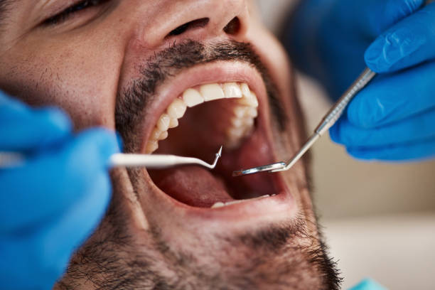 Emergency Dental Services in Hughesville, MD